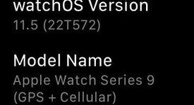 Good
													Apple Watch Series 9 41mm - Unlocked, Silver, A2982 - Cellular, Aluminum, photo 3 of 20