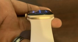 Good
													Apple Watch Series 4 40mm - Gold, A1977 - GPS, Aluminum, photo 5 of 9