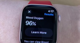 Mint
													Apple Watch Series 9 41mm - Pink, A2978 - GPS, Aluminum, photo 3 of 19