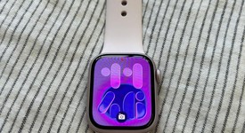 Good
													Apple Watch Series 9 41mm - Pink, A2978 - GPS, Aluminum, photo 1 of 8