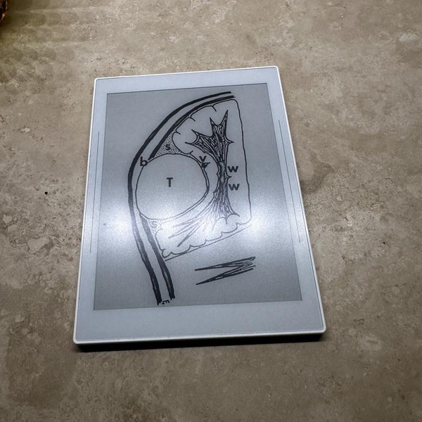 Ratta Supernote Nomad A6 X2 - White